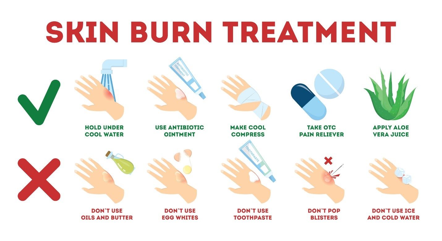 best treatment for second degree burns