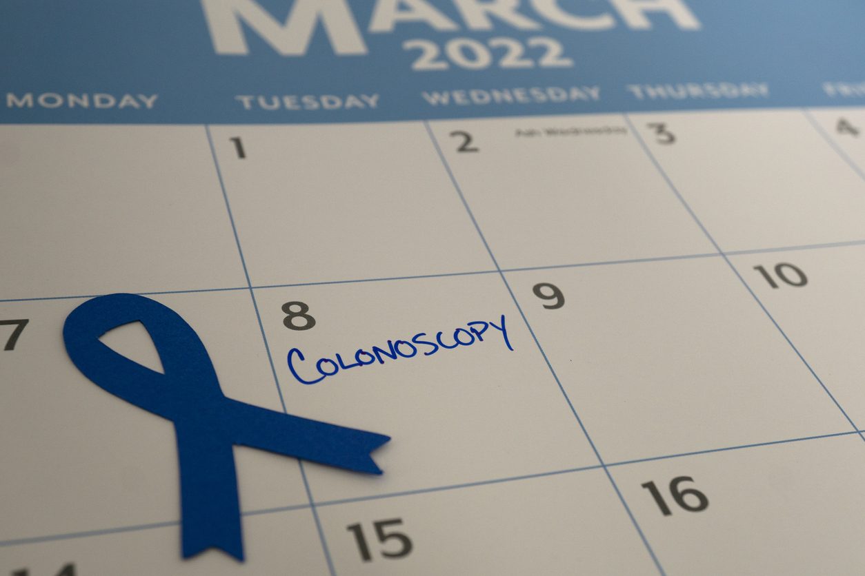 colon cancer