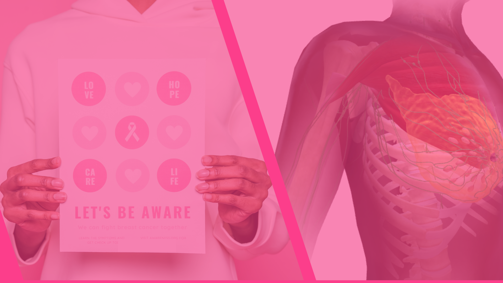 Breast Cancer Awareness
